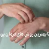 روش درمان پوست مرغی