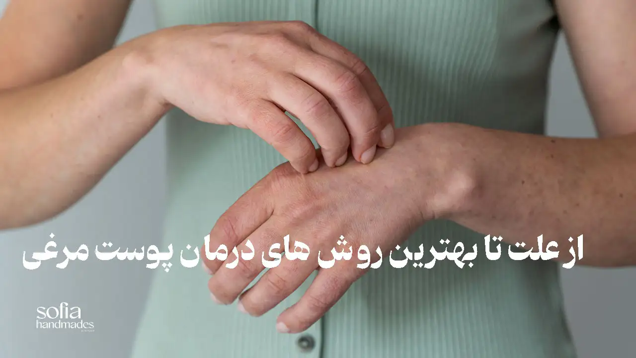روش درمان پوست مرغی