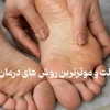 علت ترک پا