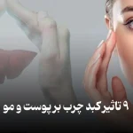 تاثیرات بیماری کبد چرب بر پوست و مو