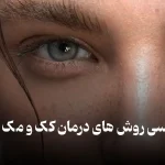 کک و مک چیست