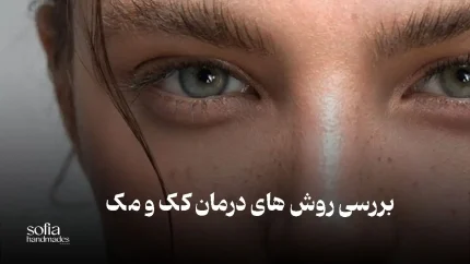 کک و مک چیست