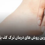 علت ترک کف پا
