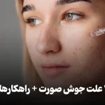 دلایل بروز جوش