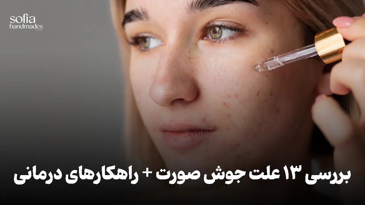 دلایل بروز جوش